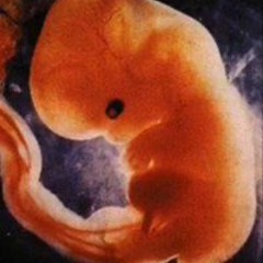 Charliesheen Isindensin