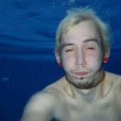 Aaron Dickinson 2