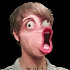 xraysens