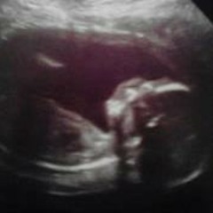 Brittany Lynn Church