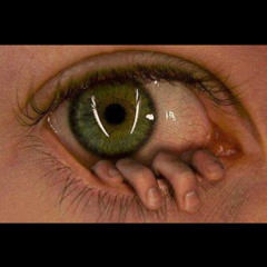 Eye See
