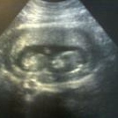 Chantelle Eyvonne Stella