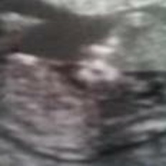 Gemma Murphy-Sanderson