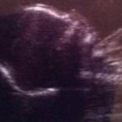 Stephanie Kleehammer