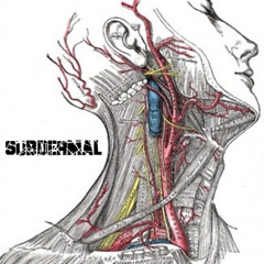 subdermal-band