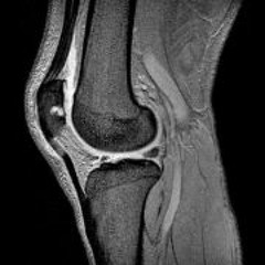 Benjamin Schloßmacher