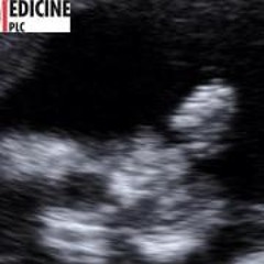 Leslie Caldwell-Severns