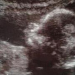 Xelithaa Bonithaa Muñoz