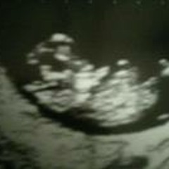 Alley Austin Gardner