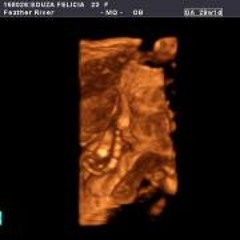 Ryan N Felicia Souza