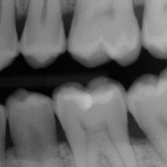 Alex Ward of TDE and HARQ