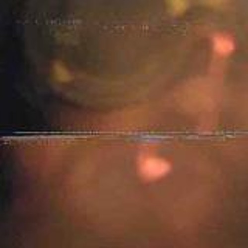 Altered State - Almark and #WEATNU