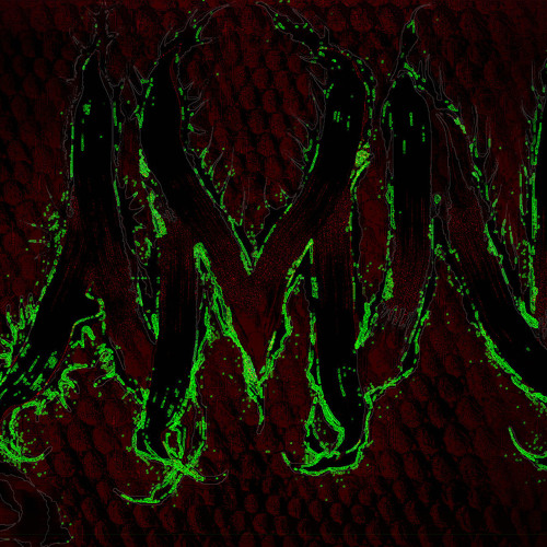 Heartless to Hurtless