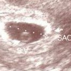 Carlos Carroza Sandaño