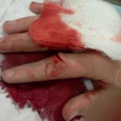 Christopher Allen Lane