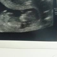 Peter William Woollard