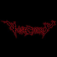 Vasectomy