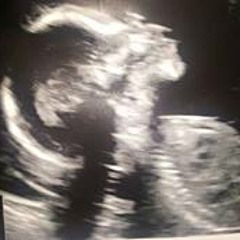 Zestherleena Robertson