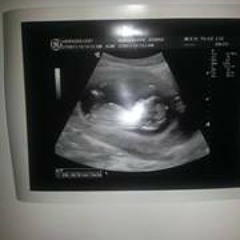 Matty Knuckles Presnell