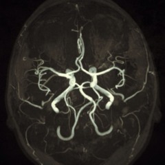 deleuzium