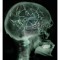 Catastrophic Mind