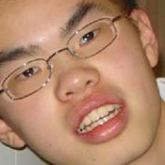 wacht dotes video so how