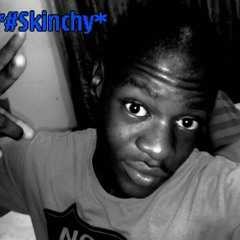skinchy 103