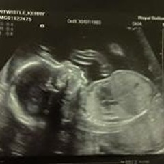 Kerry Louise Entwistle