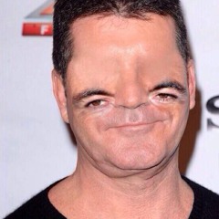 Scolo Dolo