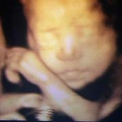 Joyce Anne De Cuaresma