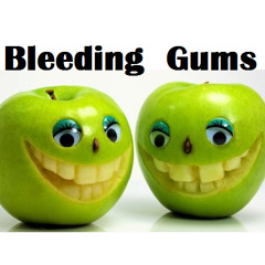 Bleeding Gums Dublin