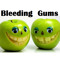 Bleeding Gums Dublin