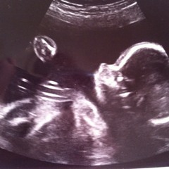 Kimberley Mitchell 4