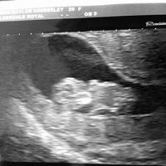 Kimberley-ann Webster