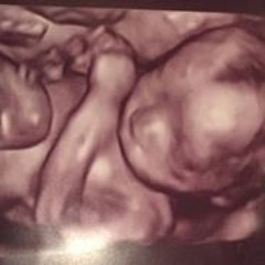 Elizabeth Kristen Hlotke