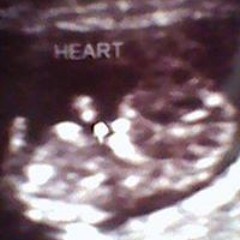 Melmisfitsprincessmell