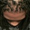 Stro