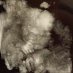 Stephanie Hitchcock 1