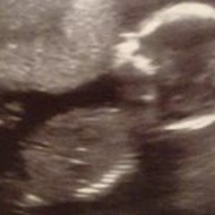 Brooke Elaine Beckner