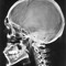 xrayz