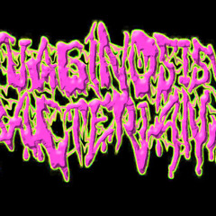 Vaginosis Bacteriana