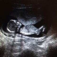 Kathleen Downard Cameron