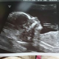 NkaujZoo Linda Yang Lee