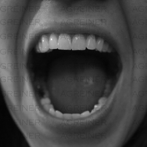 Rel G - Sirdis Zudike