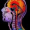 Brainhack