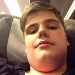 flattfott