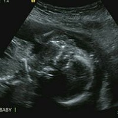 Kersten Amanda Polena