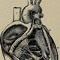 tricuspid paracardiac CT