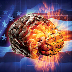 Brain Slang
