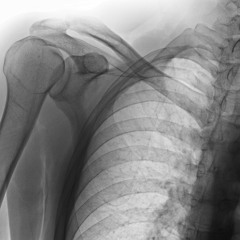 ₵ΔʟMł₦Δłʘ₦